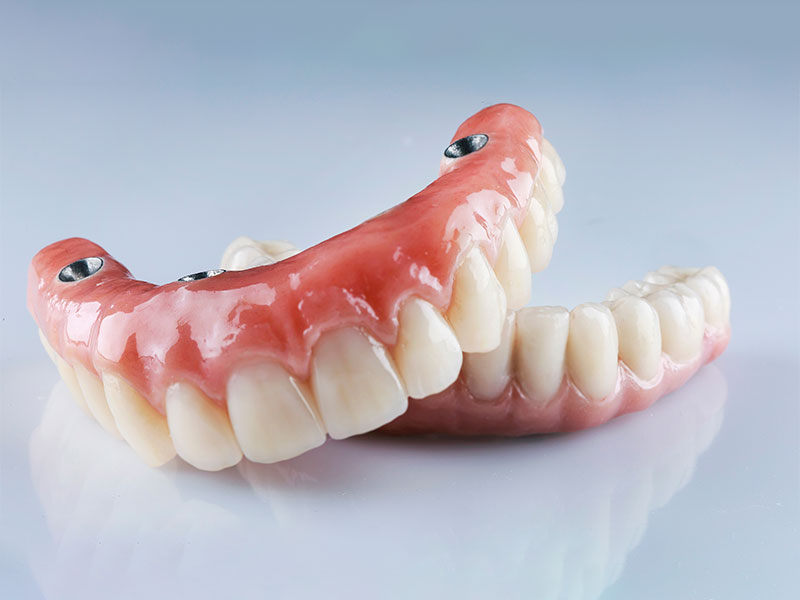 Protesi dentali